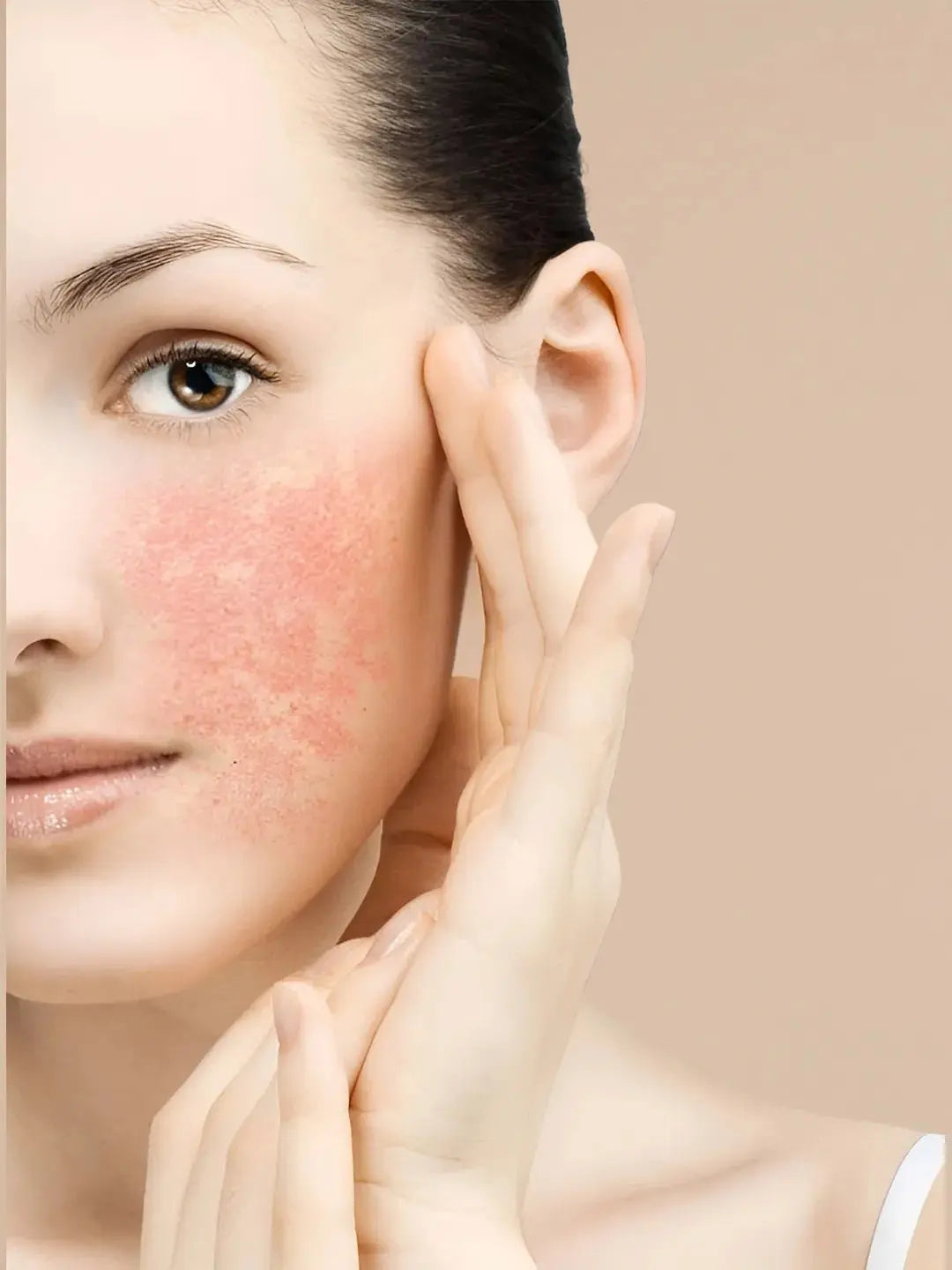 Sensitive Skin Reactions - Barclay Italy